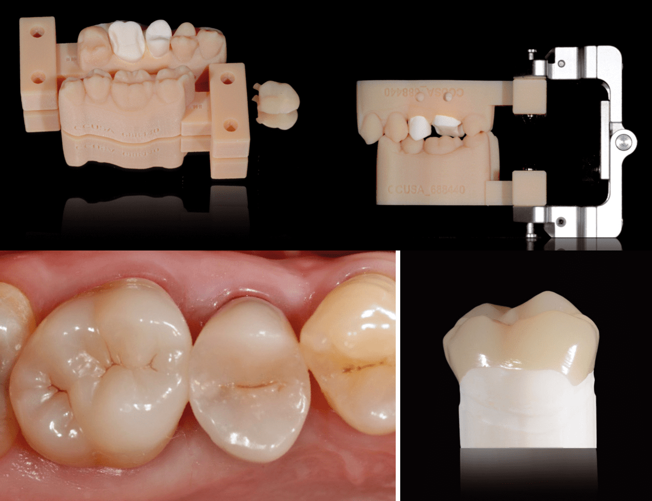 3 / Modelli da stampa 3D 4 / Realizzazione finale post cementazione Credits: Dr. G. Ori