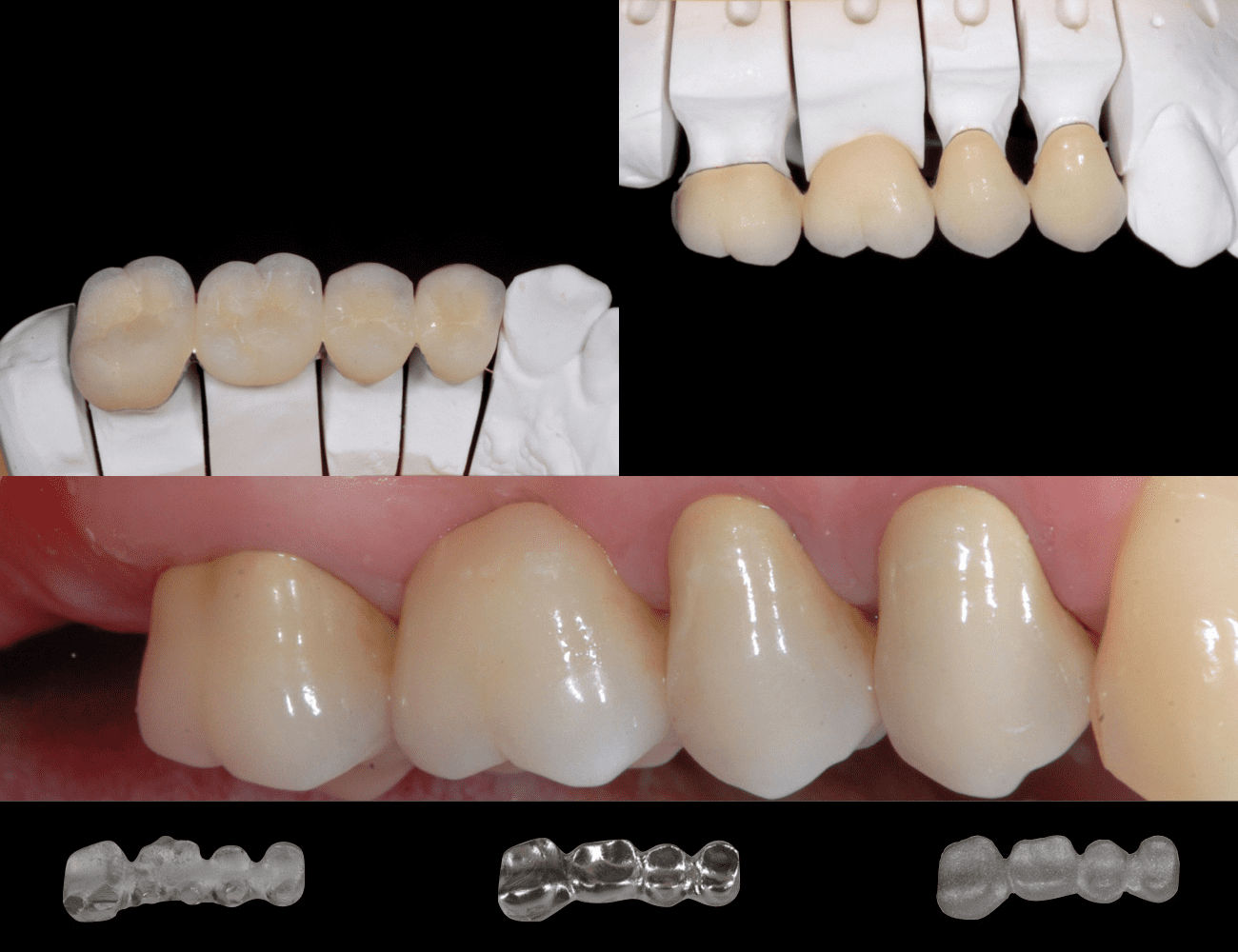 3 / Struttura con ceramica 4 / Realizzazione finale - 3 tipologie produttive Credits: Prof. C. Monaco