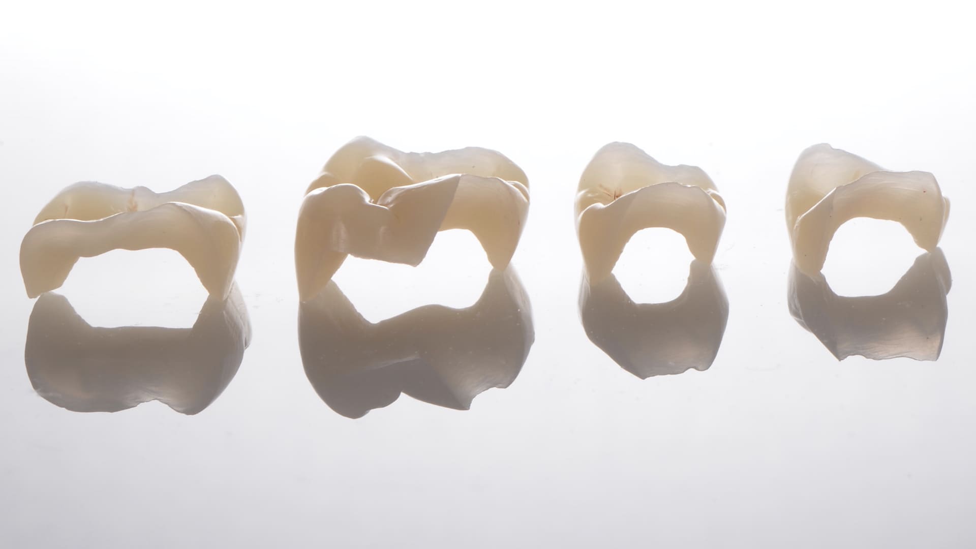quattro denti in fila su fondo bianco. rappresentazione linea xline di nexxta laboratorio odontotecnico con sede a modena, bologna, rimini e udine