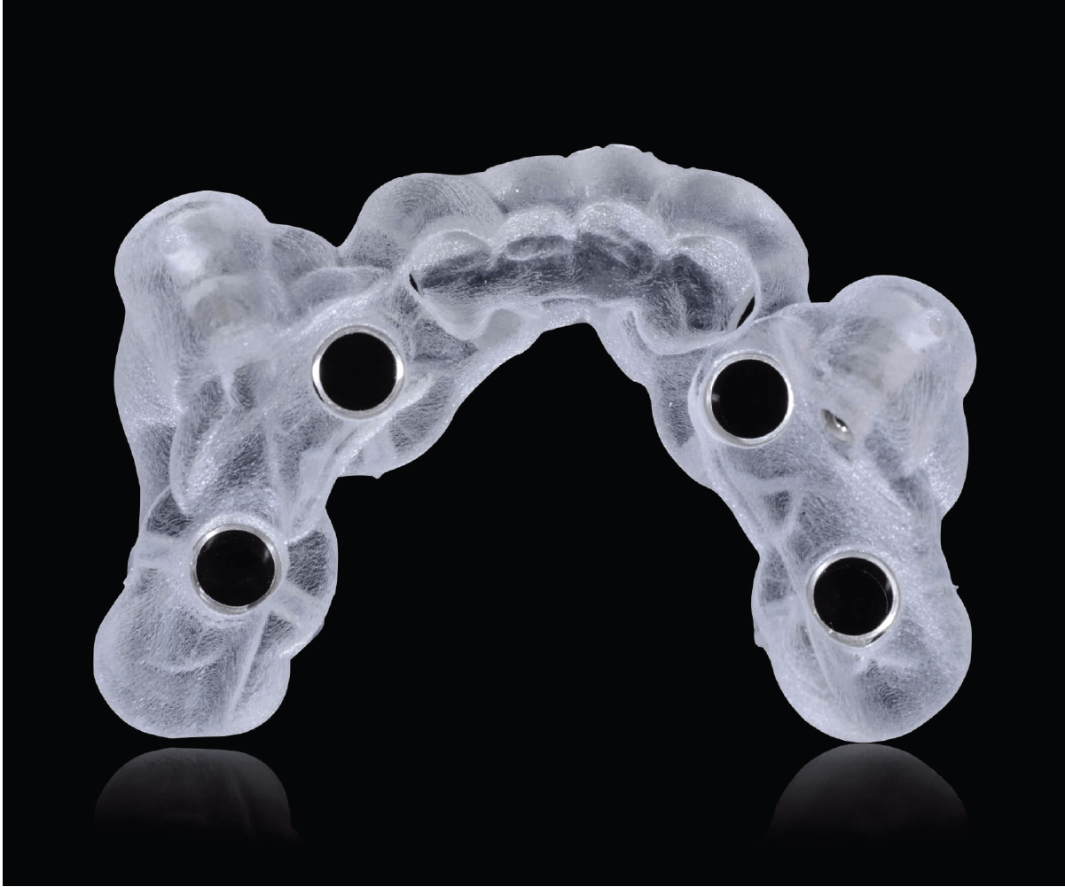 Guida chirurgica trasparente per impianti dentali