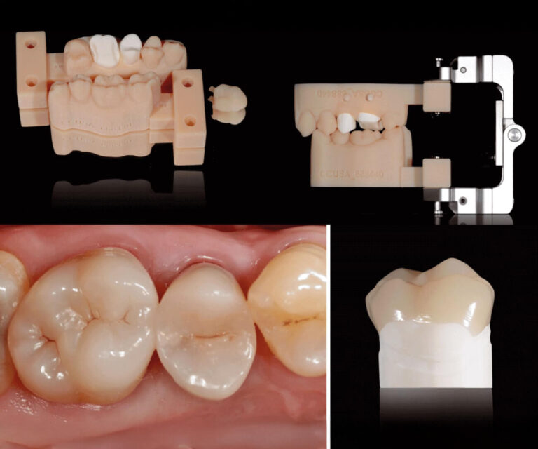 xline-Iintarsio-resin-nano-ceramic-02